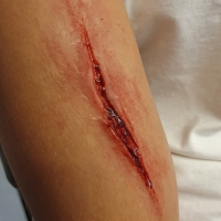 Casualty-Effects-gash-5