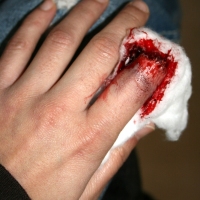 Casualty-Effects-severed-finger-1