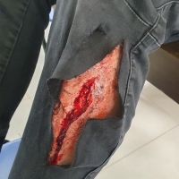Casualty-Effects-Cut-in-leg