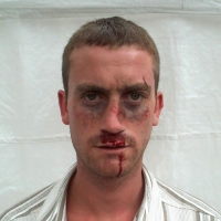 Casualty-Effects-car-aacident