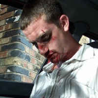 Casualty-Effects-car-accident-2