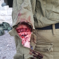 Casualty-Effects-cuts-in-arm