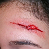 Casualty-Effects-forehead-gash-1