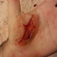 Casualty-Effects-gash-4