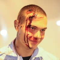 Casualty-Effects-head-gash