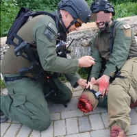 Casualty-Effects-paramedic-treating-severed-leg