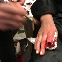 Casualty-Effects-severed-finger-2