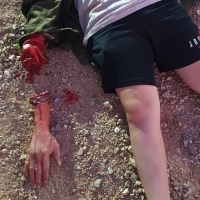 Casualty-Effects-severed-hand