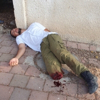 Casualty-Effects-severed-leg